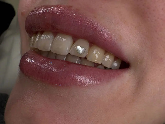 Brillo en el diente que es