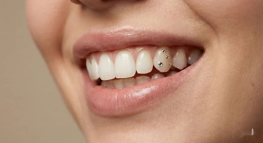 Joyería Dental: Qué Es, Tipos de Joyas Dentales y Cuál Elegir